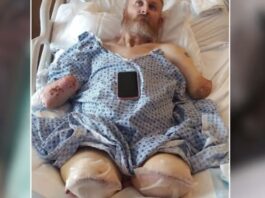 Horrific Medical Mishap: Man Amputated After Kidney Stone Surgery