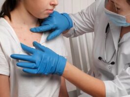 Measles Outbreak Grows: Urgent Warning for JFK Airport Travelers